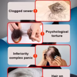 Generation 2 Hair Regrowth Serum - 1 Bottle Treatment