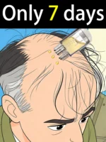 Generation 2 Hair Regrowth Serum