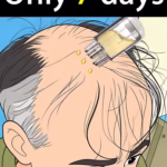 Generation 2 Hair Regrowth Serum - Follicle Activation